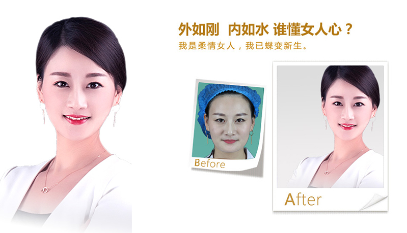 毕节地区V脸、线雕隆鼻